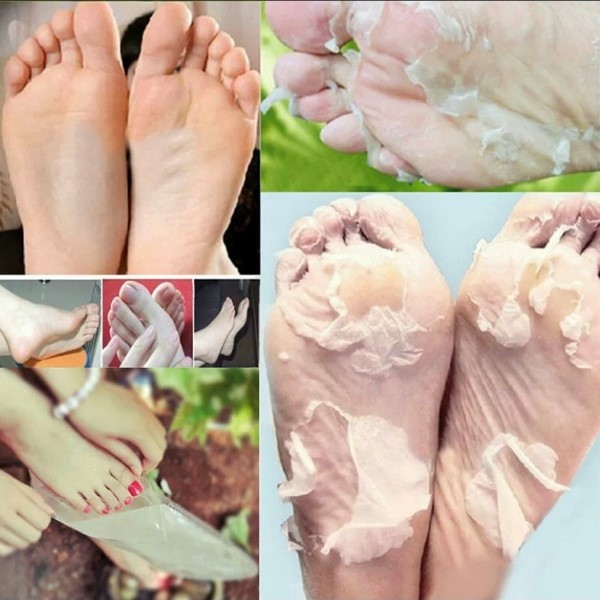 Exfoliating Socks au Maroc- FOOT CARE