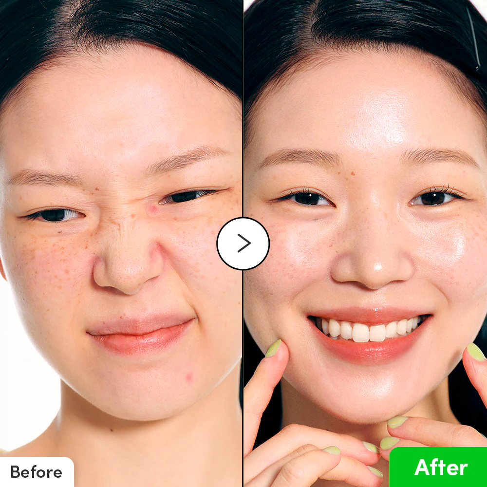 sérum anti-rougeurs et irritation