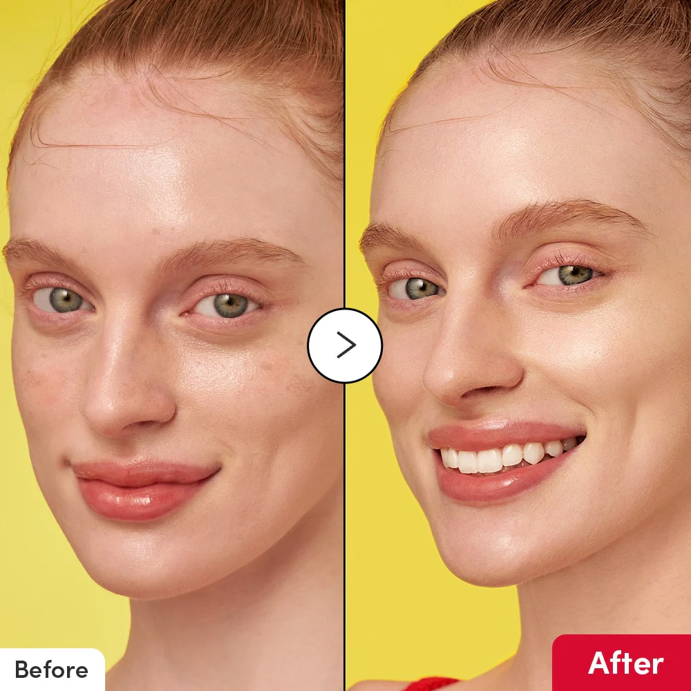 sérum anti taches brunes